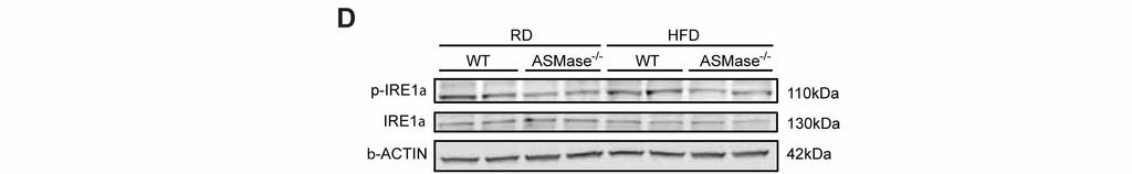 ASMase deficiency prevents HFD-induced