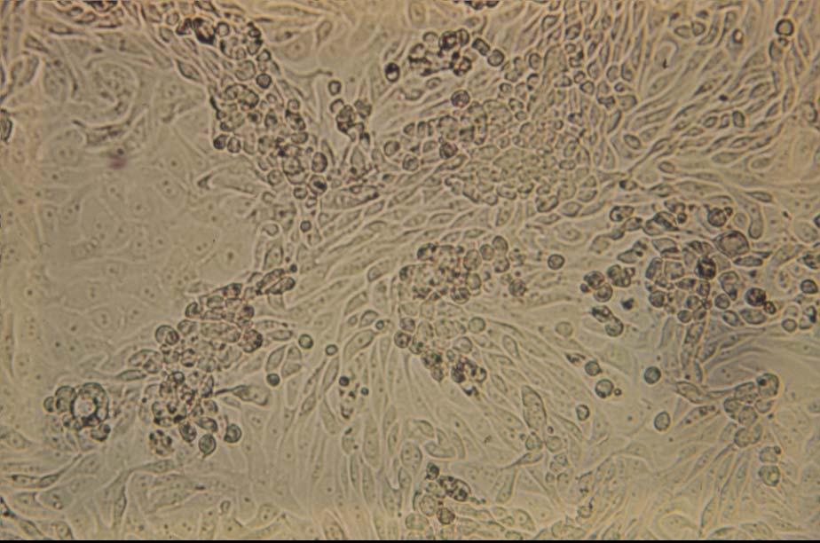 Primary rhesus monkey kidney cells infected with echovirus