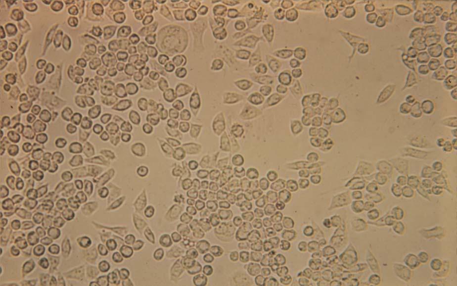 22 HEp-2 cells infected with herpes simplex virus (late CPE), 125X