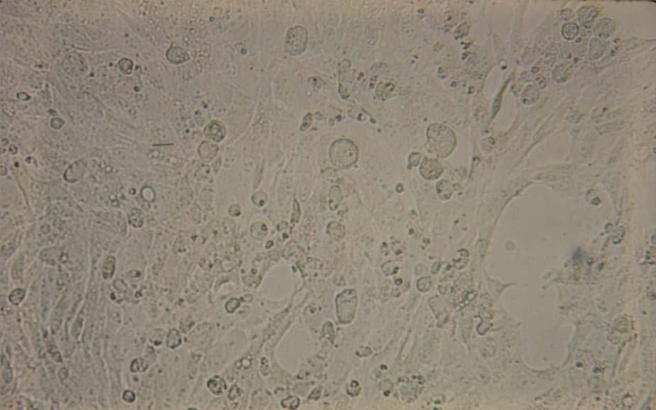 32 SIRC (rabbit cornea) cells infected with rubella virus (late CPE), 125X Most of the monolayer consists of
