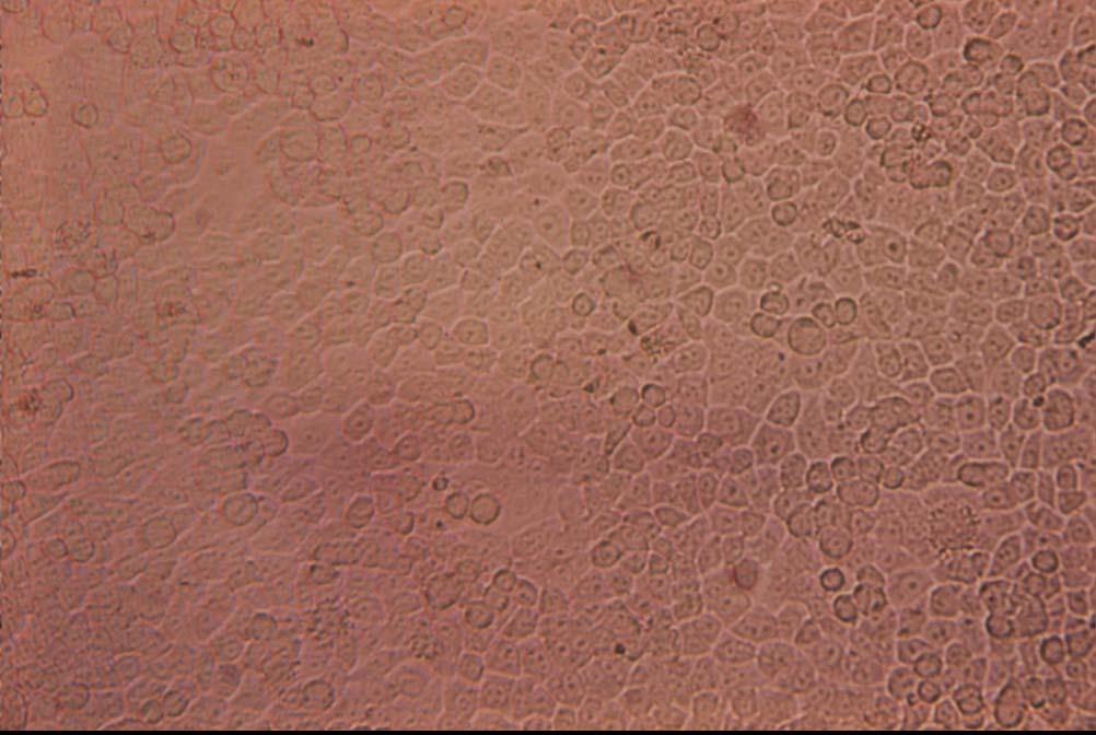 Normal HEp-2 cells at inoculation, 125X The monolayer consists of short,