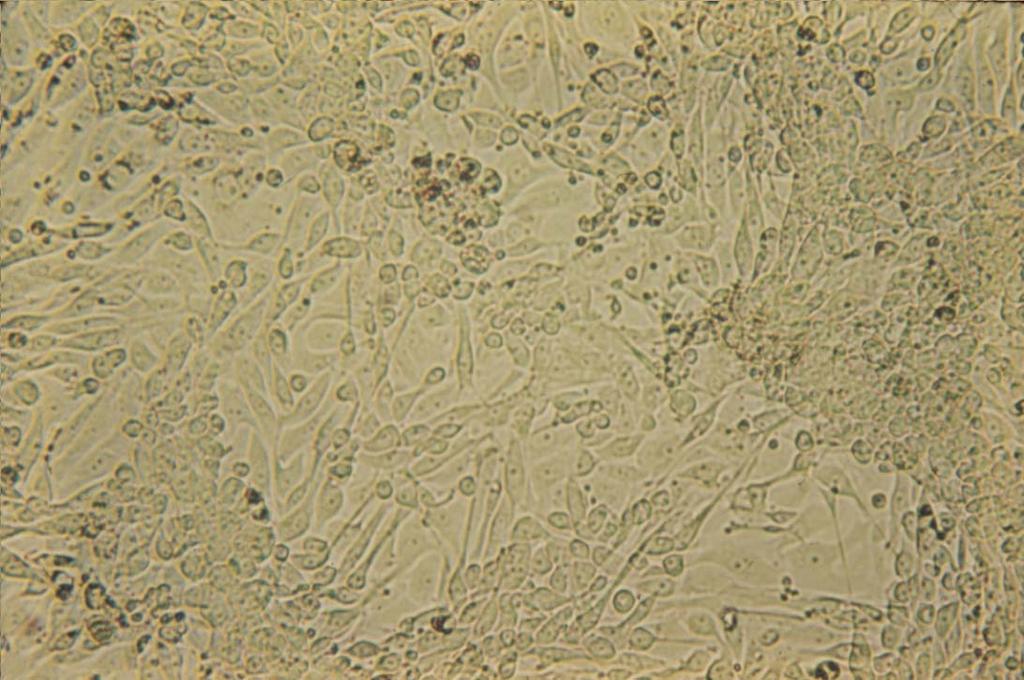 Primary rhesus monkey kidney cells infected with vaccinia virus (early