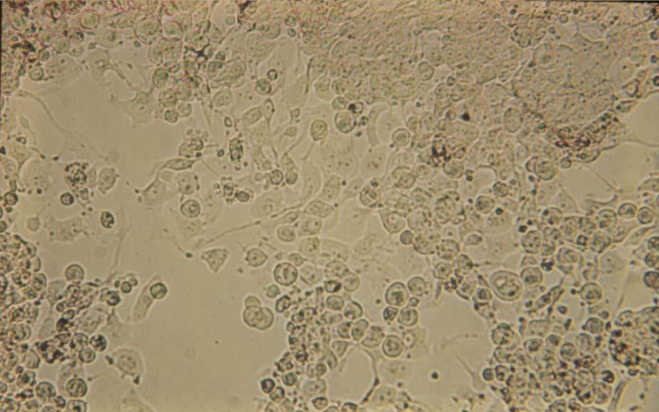 Primary rhesus monkey kidney cells infected with vaccinia virus (late CPE), 125X Large