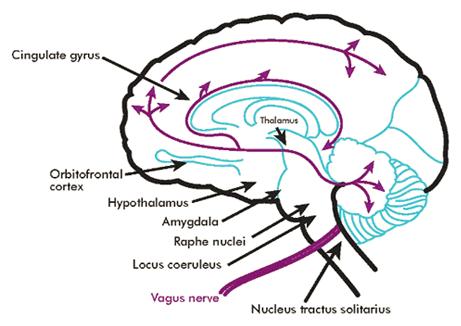 Biology of Depression: Neuro-Transmitters Nor- Epinephrine Pleasure Pathways are Stimulated by NE Low NE > mostly causes Psycho-Motor Retardation Dopamine Cocaine works on Dopamine Pathways Low