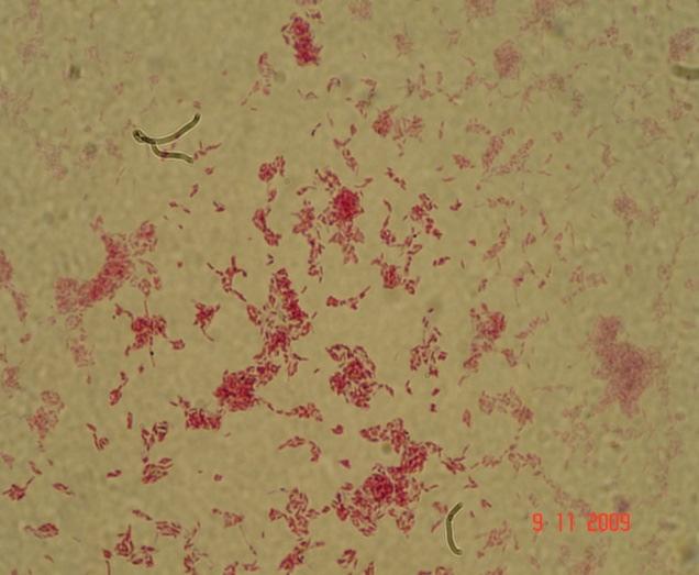 Species identification of mycobacteria using MALDI-ToF mass-spectrometry