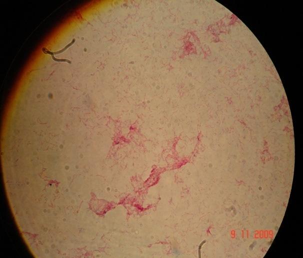 microbiological (Ziehl- Neelsen staining, growth on TCH medium and sodium
