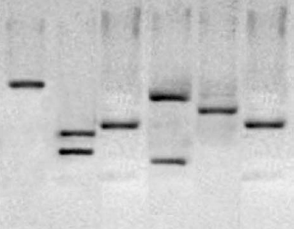 and MTBC Sequencing PCR