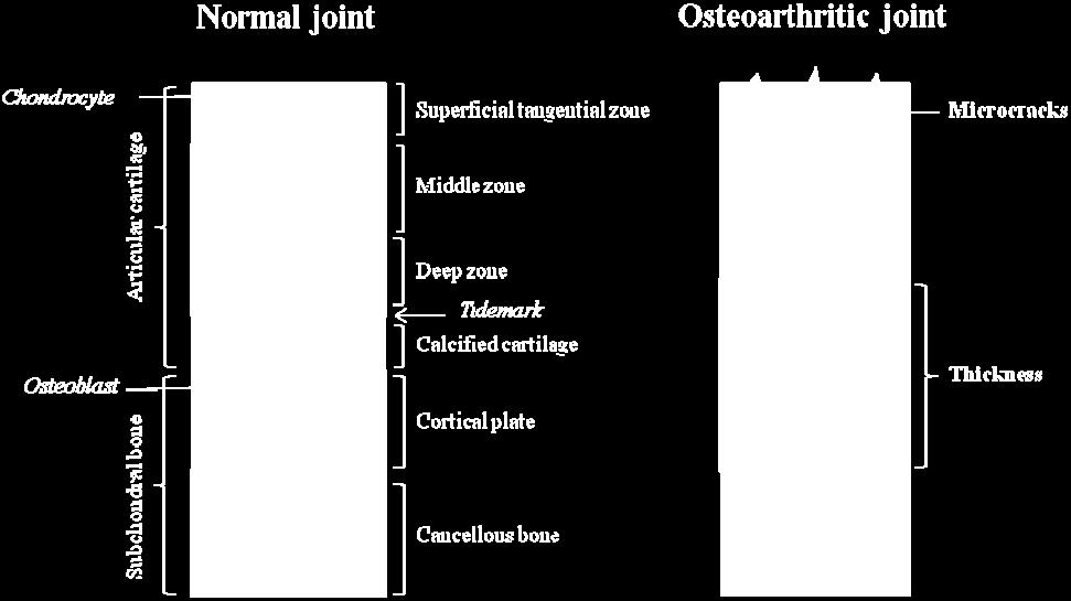 sometimes menisci [14]. Broadly, articular cartilage consists of four zones; the superficial, middle, deep and calcified zone (Figure 1).
