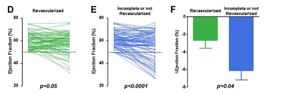 Impact of Revascularization on Longitudinal Changes in LVEF
