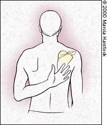 1-Testing abduction and external rotation( +ve sign touch the opposite scapula, -ve sign