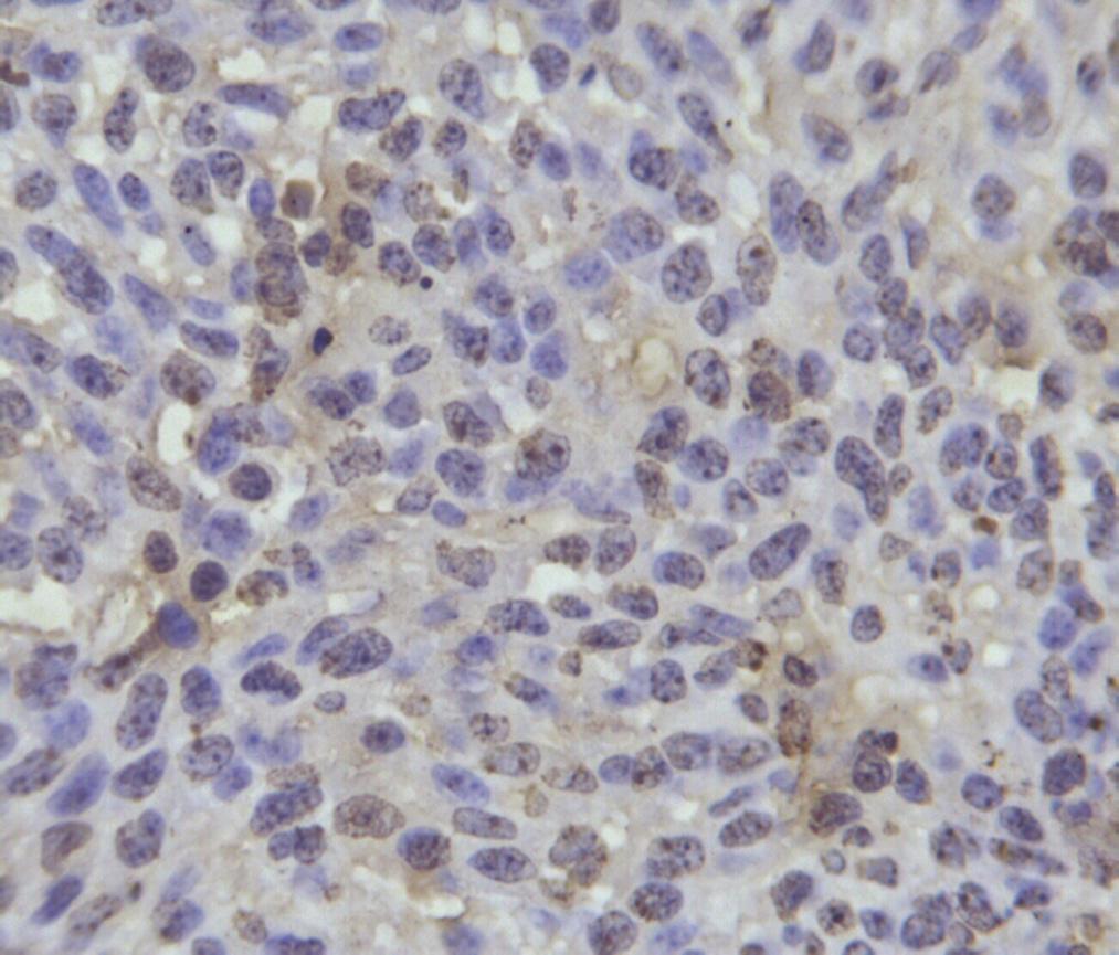 638 Wen et al. Figure 2: The H&E stained images of T739 mice tumors after cryoablation ( 200). erally cryodamaged zone.