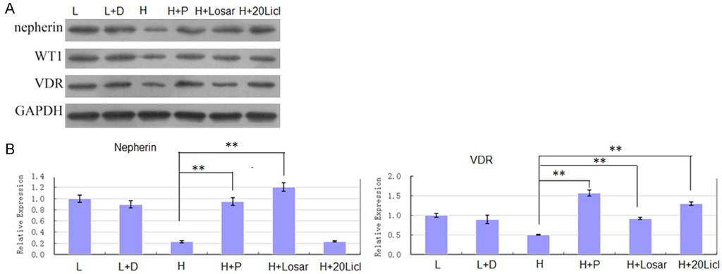 Figure 3. Paricalcitol effects on expression of relative markers. A. The protein level of nephrin, WT1, and VDR in different conditions; B. The mrna levels of nephrin and VDR in different conditions.