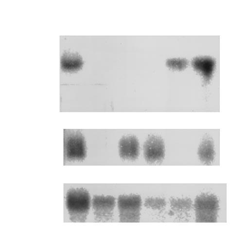 a b Figure 3 Northern blot analysis of polyribosomal RNA fractions from TG and brainstem tissues of mice latently infected with HSV-1.