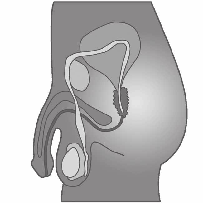 Spermatic Cord Prostate