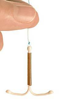 and typical use Copper IUD Extremely safe, non-hormonal, highly effective, and
