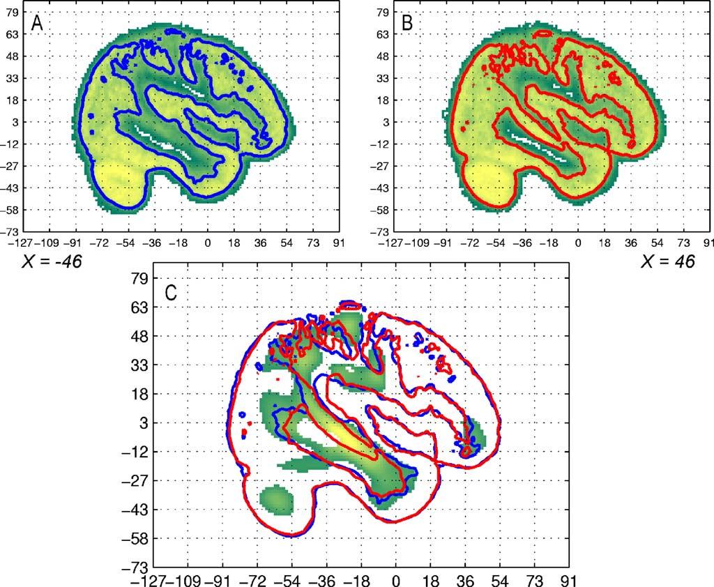 P.-Y. Hervé et al. / NeuroImage 29 (2006) 1066 1079 1073 Fig. 5.