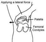 Patella Apprehension Test Manual lateral