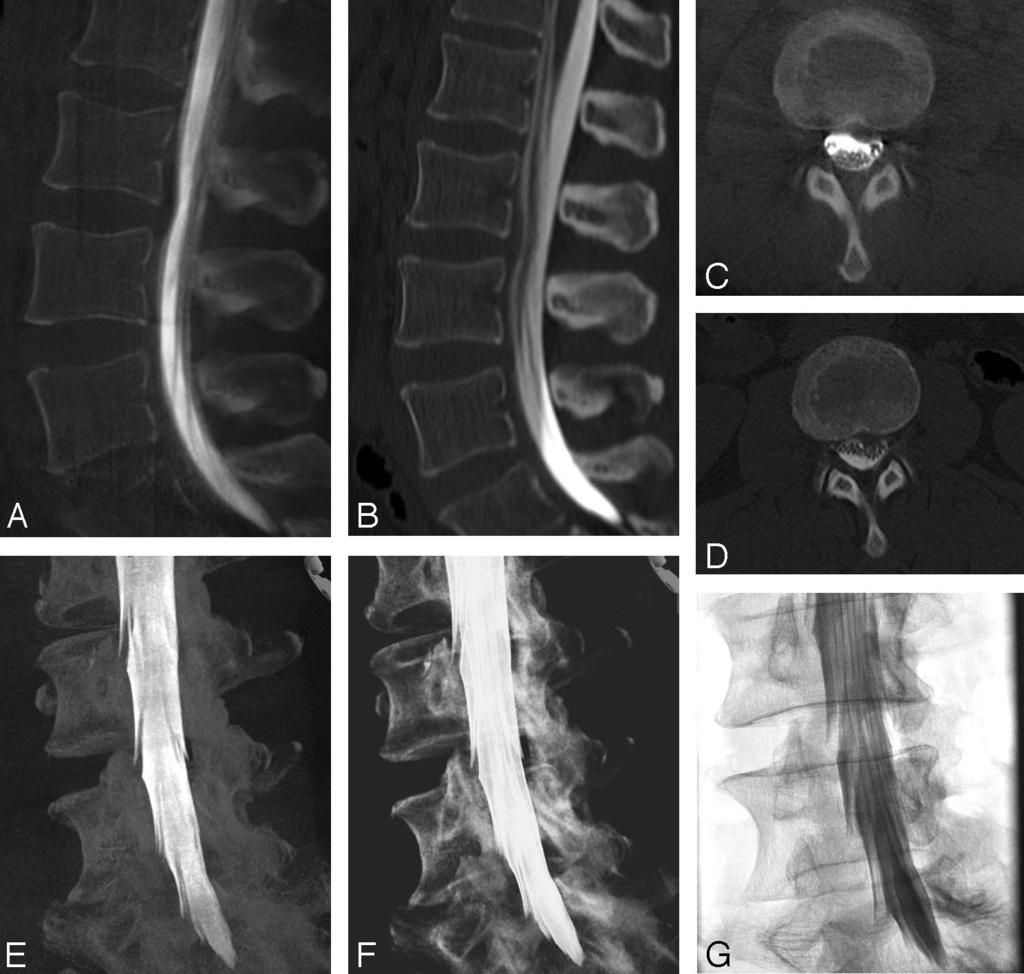 Fig 1. Images from a 58-year-old woman with persistent back pain.