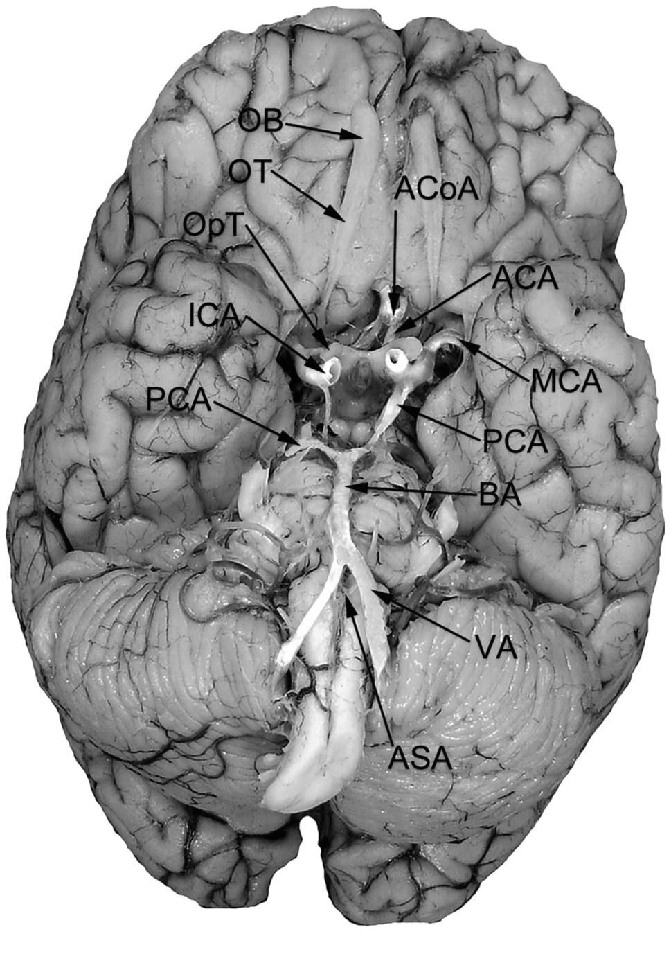 Chapter 2 / Spinal Cord and Brain 31 and two or more gyri longus insulae (Fig. 12). The middle cerebral artery passes into the lateral sulcus on the surface of the insula.
