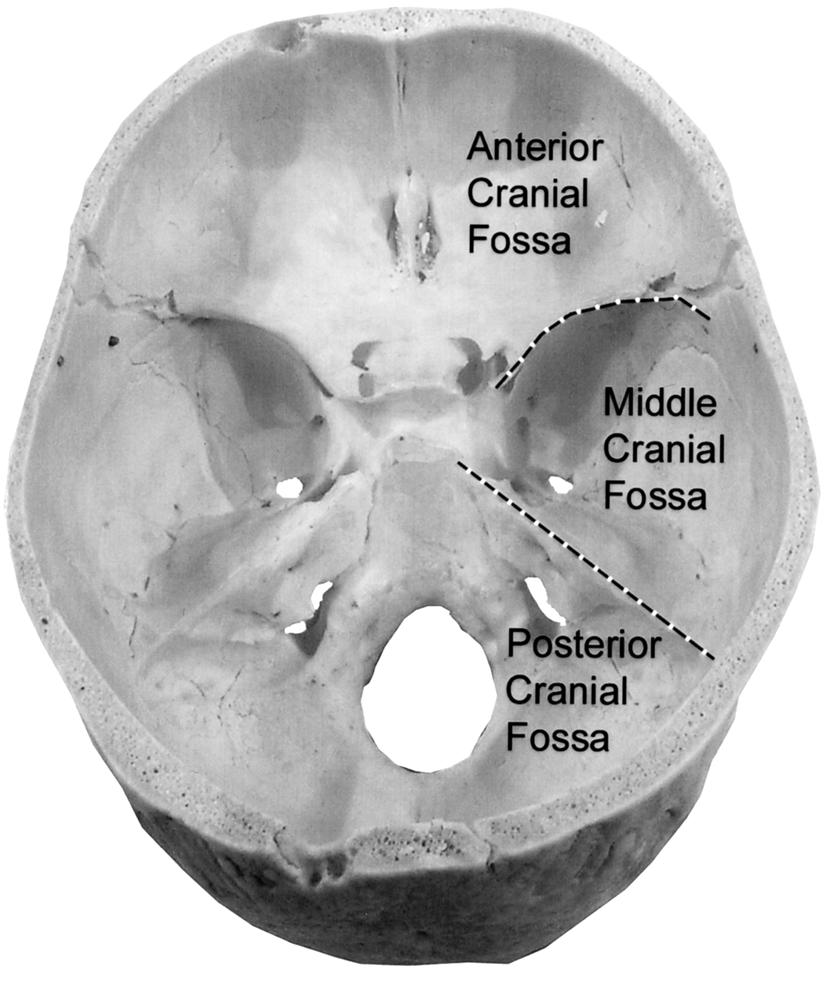 Chapter 2 / Spinal Cord and Brain 25 Fig. 4. Floor of the cranial cavity demonstrating the anterior cranial fossa, middle cranial fossa, and posterior cranial fossa. Fig. 5.