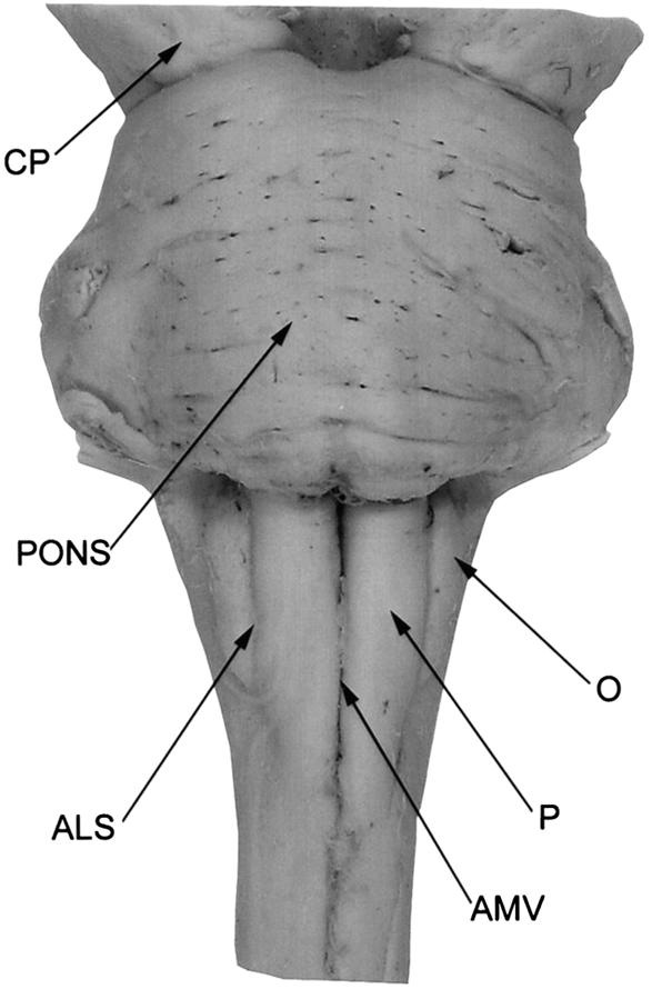 The medulla contains the pyramids (P), separated from the olive (O) by the anterior lateral sulcus (VLS). The pyramids are located on either side of the anterior median fissure (AMF).