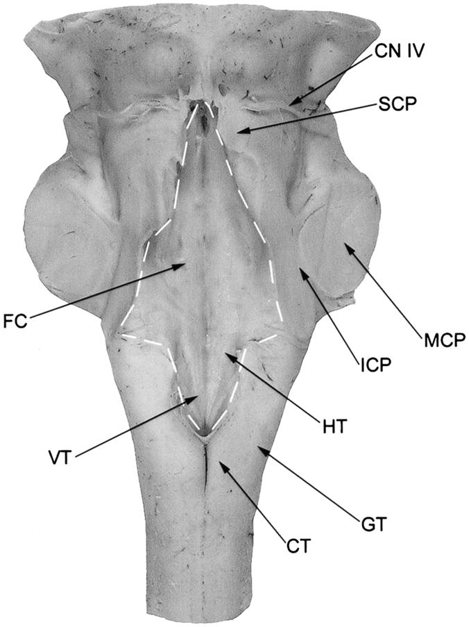 The cuneate tubercle (CT) and gracile tubercle (GC) are located caudal to the rhomboid fossa.
