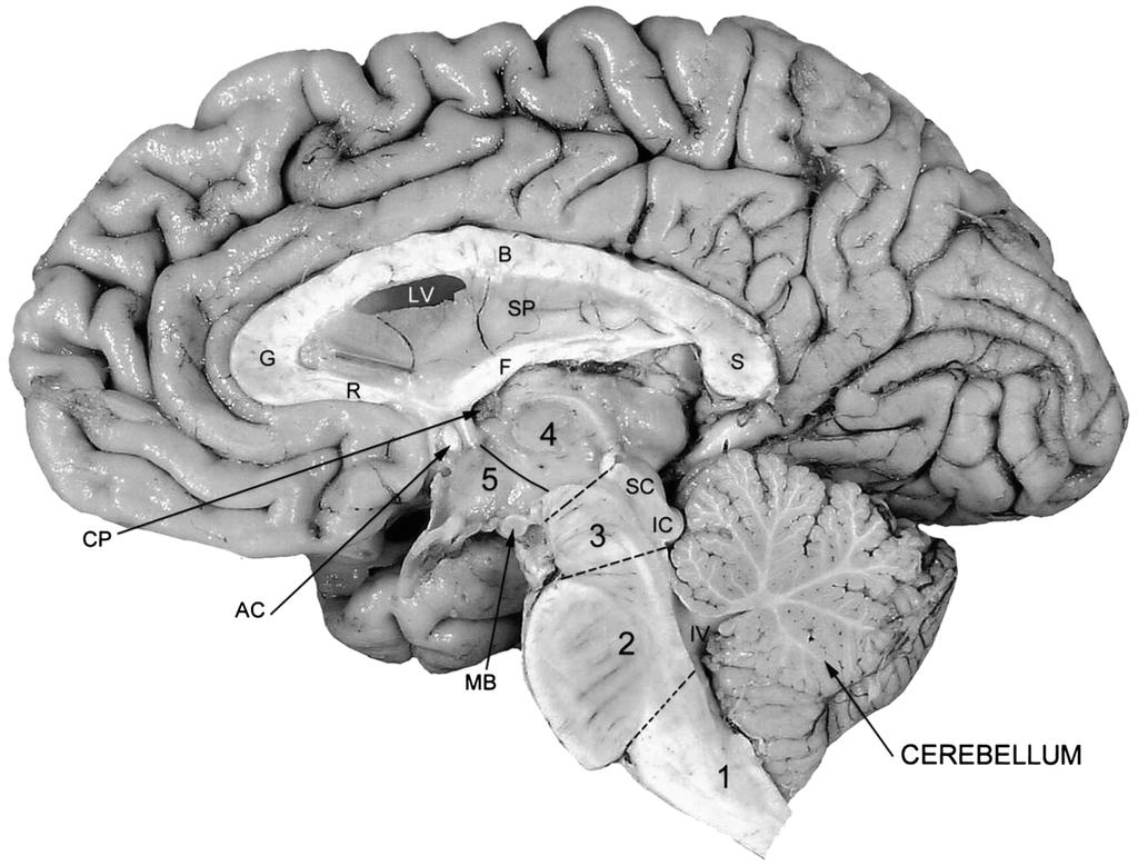 Chapter 2 / Spinal Cord and Brain 27 Fig. 8. Midsagittal section of the brain. The brainstem composed of the medulla oblongata (1), pons (2) and midbrain (3) is visible.