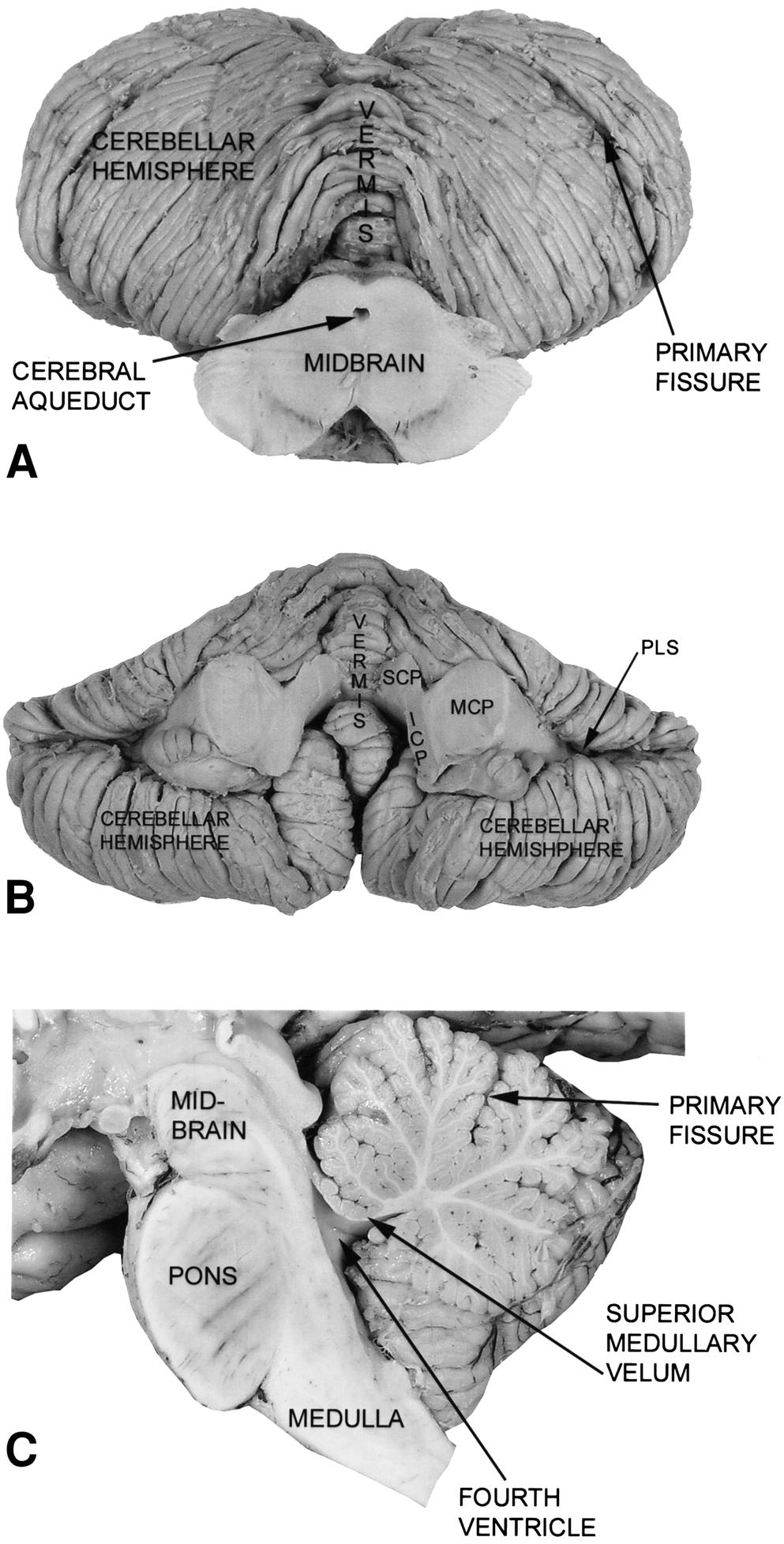 28 Maley Fig. 9. (A) Anterior view of the cerebellum. The cerebellum, with its cerebellar hemispheres and vermis, lies posterior to the midbrain.