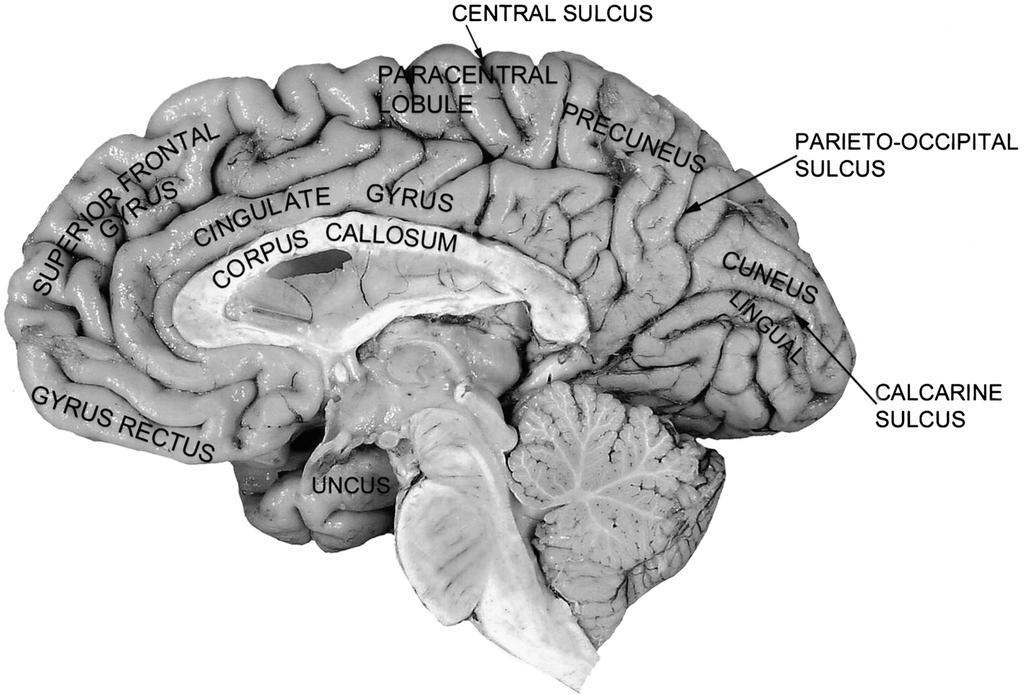 An imaginary vertical line drawn from the parieto-occipital notch separates the parietal cortex from the occipital cortex. Fig. 11. Midsagittal section of the brain with cortical gyri labeled.