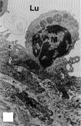 Vascular biology of atherosclerosis (a) (b) (c) (d) Figure 1 (a) TEM of monocyte (M) trapped in junction of endothelium (E) from arch area of 12-week pig.