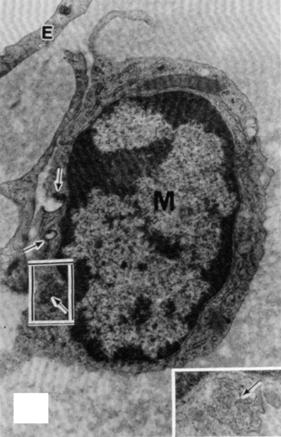(b) Monocyte (M) beneath endothelium (E) in a 15-week arch lesion from a pig injected with ferritin 15 min before death.