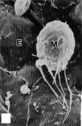 Inset shows ferritin in vacuole in squared area (unstained, 15,500; inset, 61,000). (c) SEM of monocyte (M) adherent to endothelium (E).