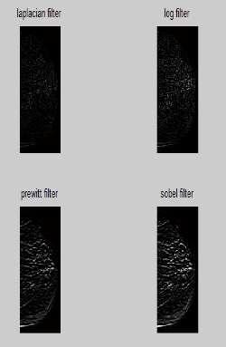3.1. Pre-Processing Pre-processing is an important part of Image processing used to remove noise, to make image smooth, to make border sharpen, to make image bright and to enhance contrast.