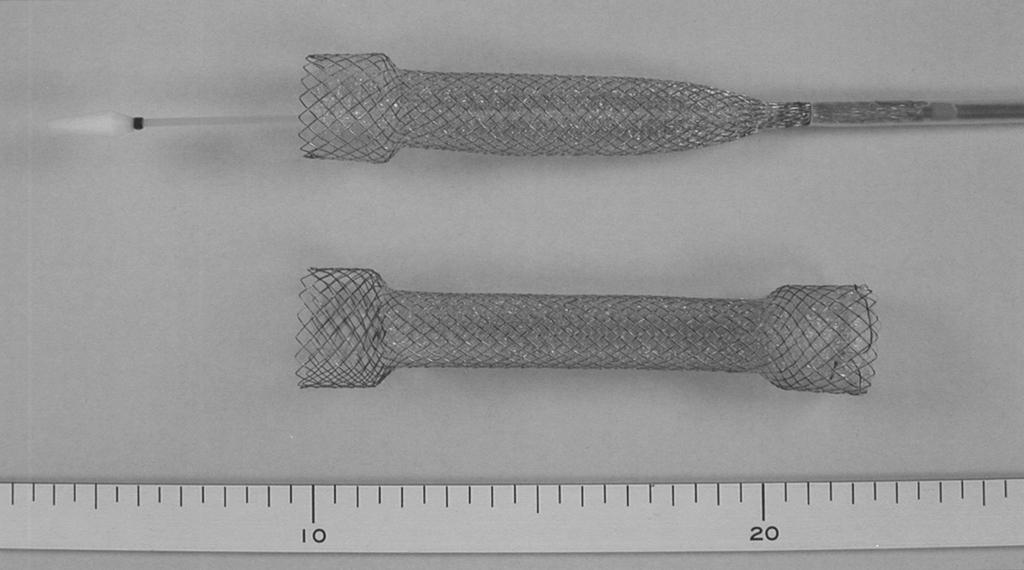 Jeong et al. Fig. 1. Photograph shows polyurethane-covered Niti-S (TaeWoong Medical, Seoul, Korea) stent before deployment with delivery system (top) and after deployment (bottom). and CT.
