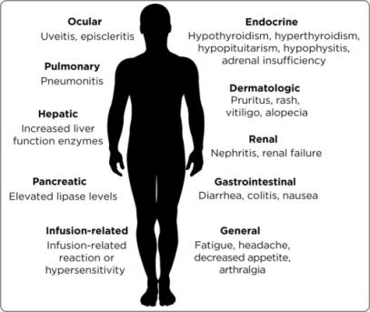 Immune Related Adverse Events (iraes) Image: Kreamer.
