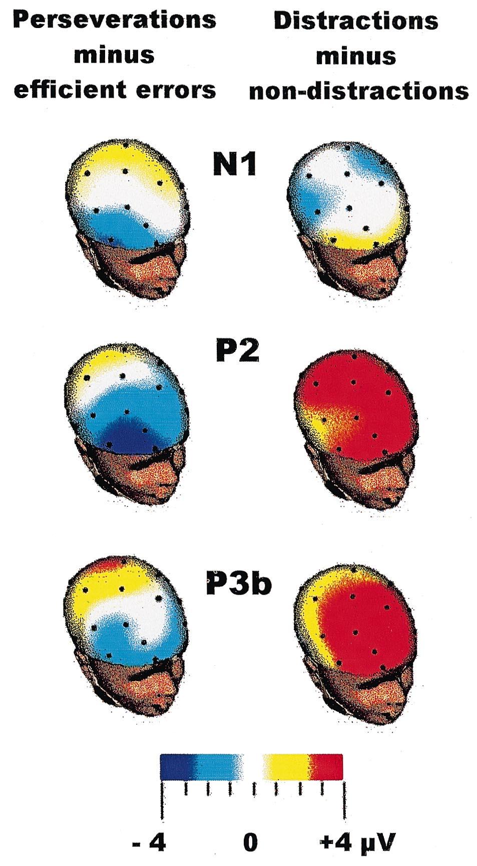 FIG. 2. Spherical spline topographical maps showing the mean difference in N1, P2 and P3b amplitudes evoked by each type of WCST error compared with their respective normal counterparts.