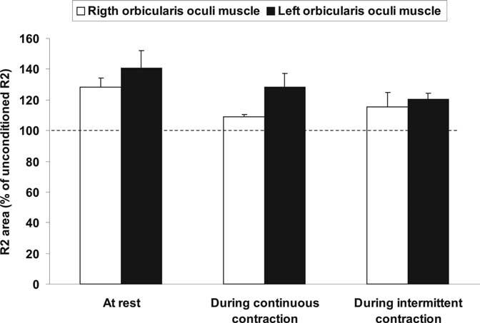 Quartarone et al. Increased Modifiability of Reflex Blinks in BEB J. Neurosci., January 11, 2006 26(2):716 721 719 Figure 2. Blink reflexes by stimulating left untreated side.