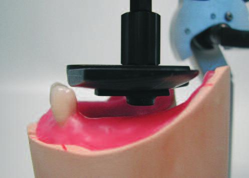 Set-up of posterior teeth For aesthetic and functional reasons, it must be made sure during set-up that the mandibular posterior teeth are not set-up too low in