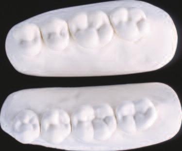 In this way, the fully anatomical occlusion is particularly suitable for partial, combination, and implant-supported dentures and requires exact definition of the individual centric.