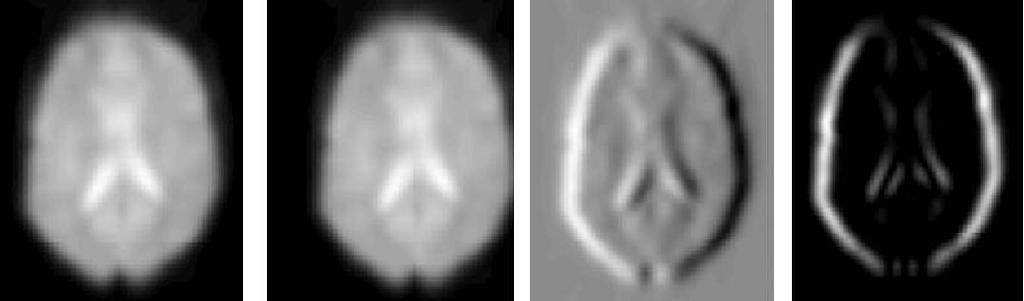 Friston, 1997; Ashburner & Friston, 2000; Frackowiak et al., 1997). One brain volume (usually the first image in the time series) is taken as the reference volume.