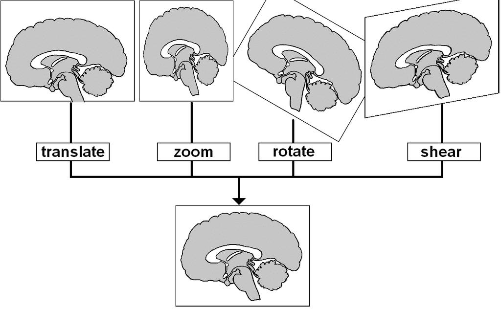 shear (skewing) deformations. Each of these linear parameters changes the entire brain in the same way and these are also known as affine parameters (see Figure 4.3).