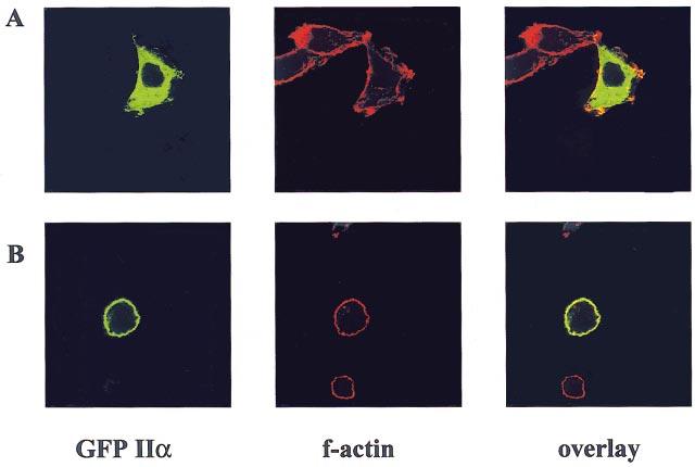 Interaction between inositol lipid kinases 569 Figure 6 HeLa cells co-transfected with GFP IIα PIPkin alone (A) or with GFP IIα PIPkin and FLAG Iγ PIPkin (B) Fixed permeabilized cells were stained