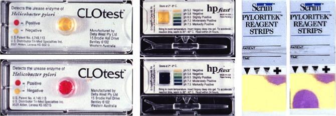 Rapid Urease Test (RUT) There are a number of different commercially available RUT kits that primarily differ depending on the platform (e.g., gel, liquid, membrane, etc.). Choice depends on availability and local preference as none has proven to be superior.
