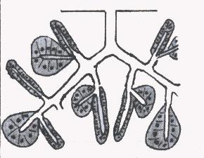 2. Alveolar (acinar): e.g.