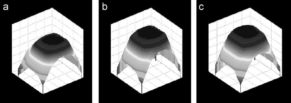 1245D R 2 =.9949 2 4 6 8 1 Dose [Gy] Fig. 3. (a) Calibration curve with linear fit. (b) View of a Fricke gel dosimeter irradiated with a 4-field box technique. Fig. 4. Normalized DOD distributions obtained by piled up gel dosimeter layers: (a) external, (b) middle, and (c) central.