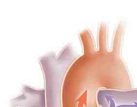 When Heart Failure Occurs In people with heart failure, the heart can t move as