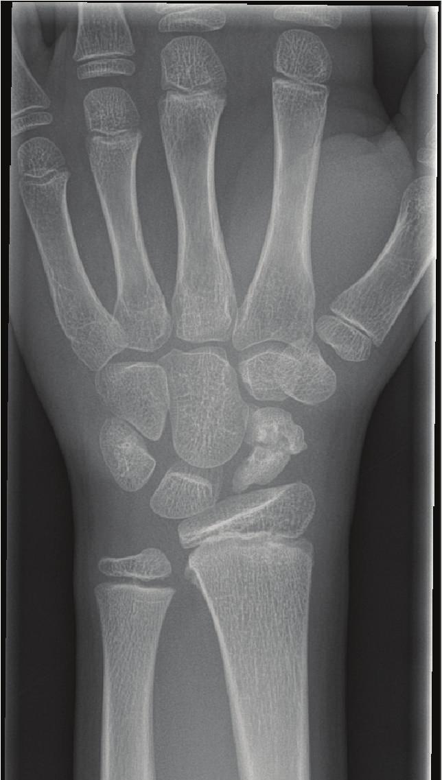 2 Case Reports in Orthopedics (c) Figure 1: Plain