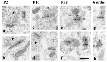 PSD-95 is expressed at low levels in neonates and