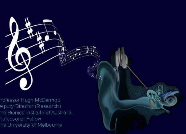 Hearing the Universal Language: Music and Cochlear Implants Professor Hugh McDermott