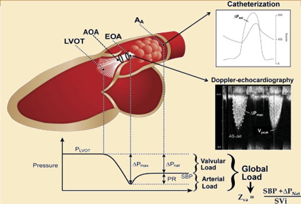 Blood Flow and Pressure Across LVOT, Aortic Valve, and